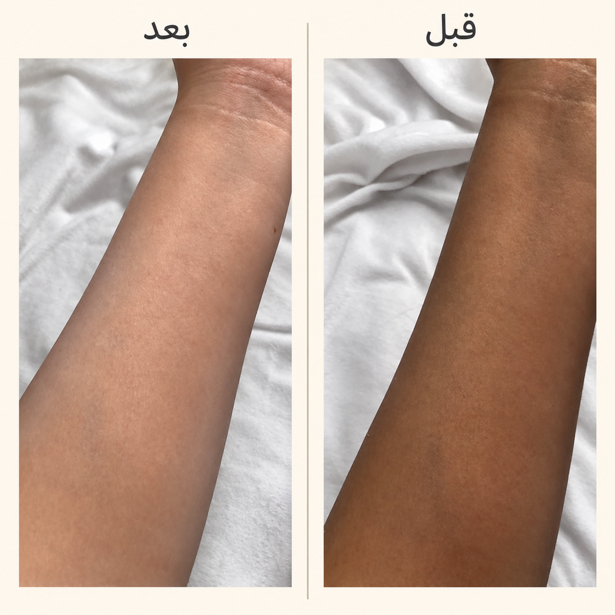 كورس بيرليا جلوتاثيون 3000mg لتوحيد لون الجسم والمناطق الحساسة